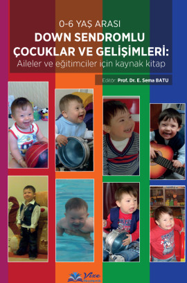0-6 Yaş Arası Down Sendromlu Çocuklar ve Gelişimleri